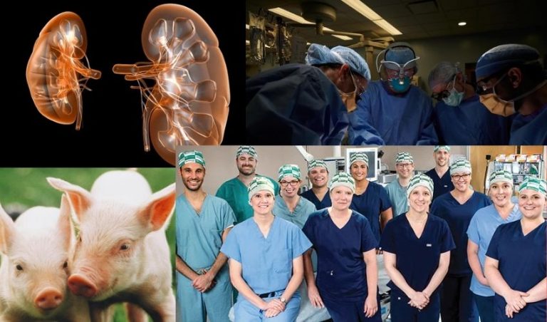 Pig Kidneys Transplanted to Human in Milestone Experiment